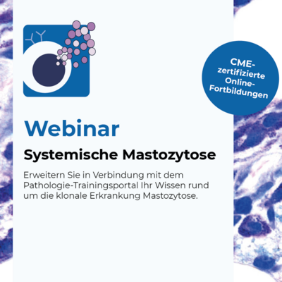 Systemische Mastozytose Teasarbild